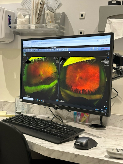 cy's eyes in red and green on a computer screen